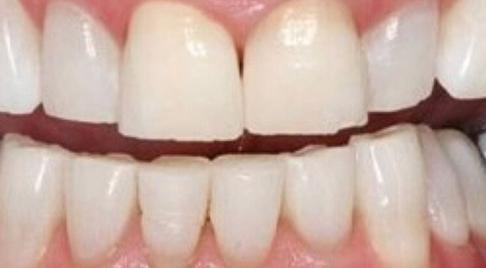 Healthy bright smile after dental treatment