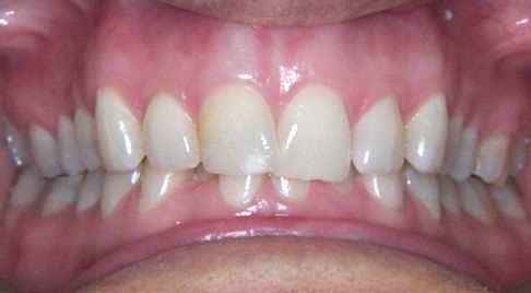 Smile before dental treatment