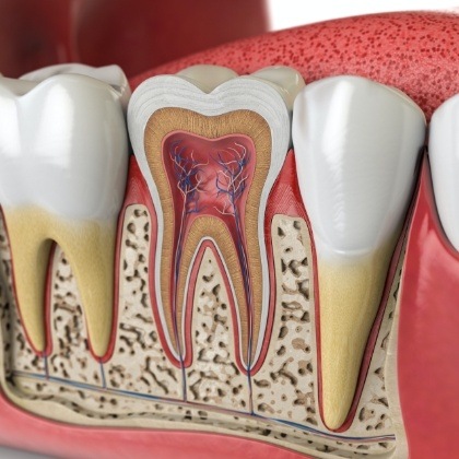 Animated inside of a tooth after root canal therapy