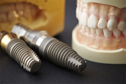 Dentist using computer system to perform the four step dental implant process