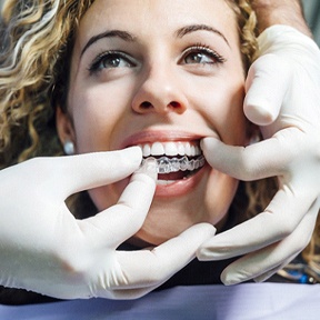 dentist putting clear aligner on patient